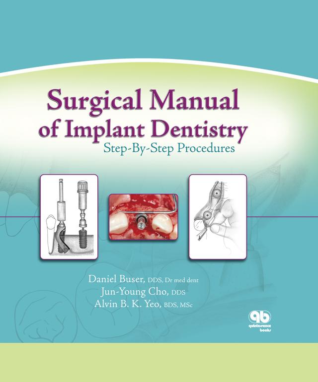 Surgical Manual of Implant Dentistry Step-By-Step Procedures 2007