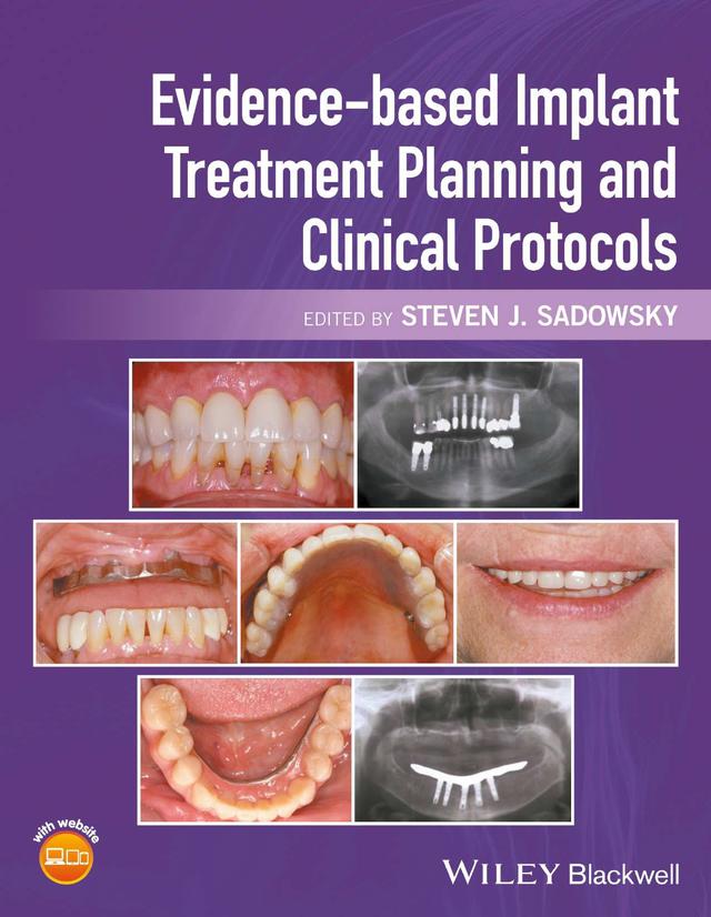 Evidence-based Implant Treatment Planning and Clinical Protocols 2017