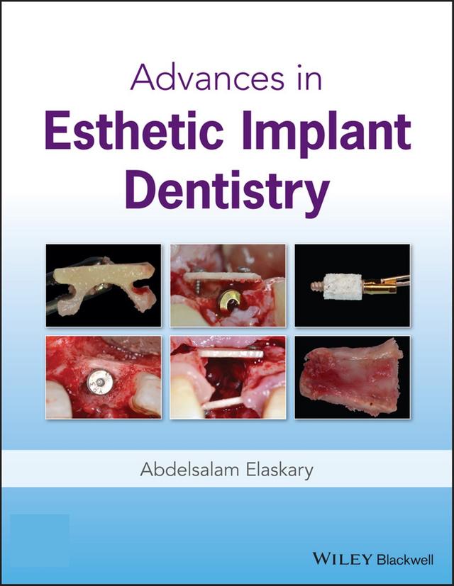 Advances in Esthetic Implant Dentistry 2019