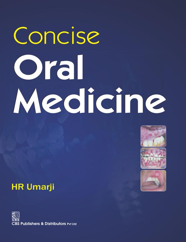 Concise Oral Medicine 2020