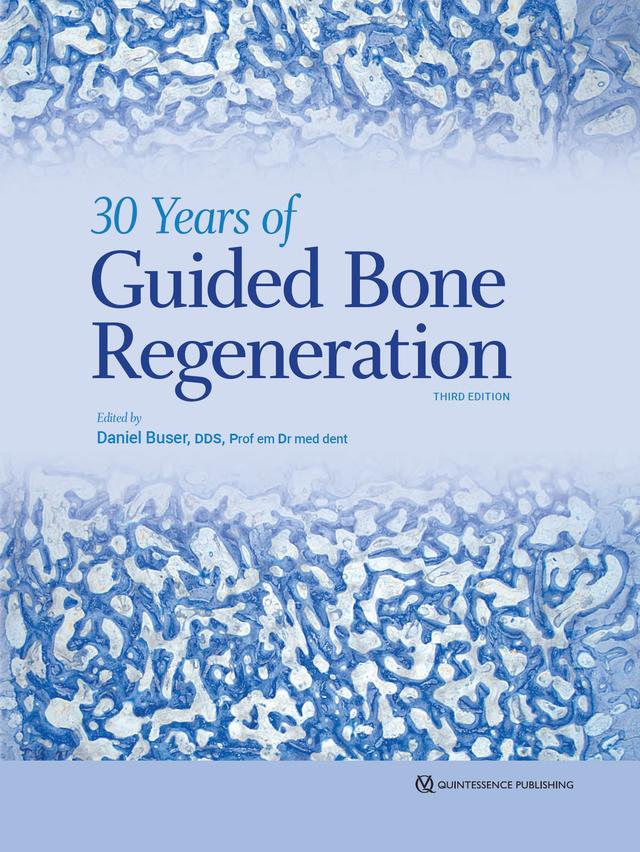30 Years of Guided Bone Regeneration 2022