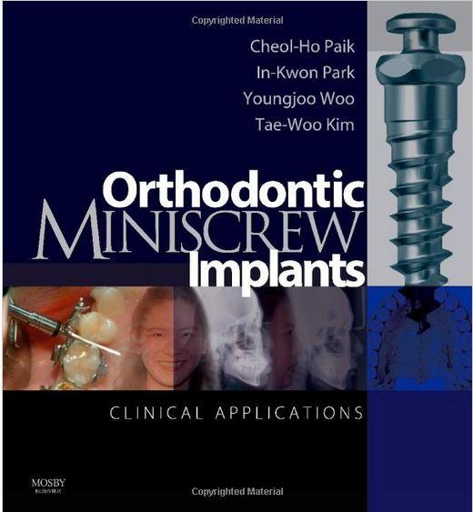 Orthodontic Miniscrew Implants clinical applications 2009