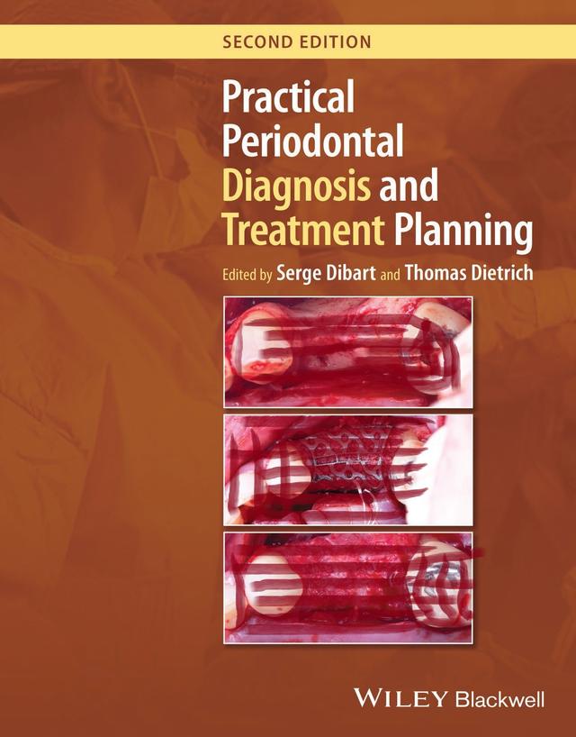 Practical Periodontal Diagnosis and Treatment Planning 2024