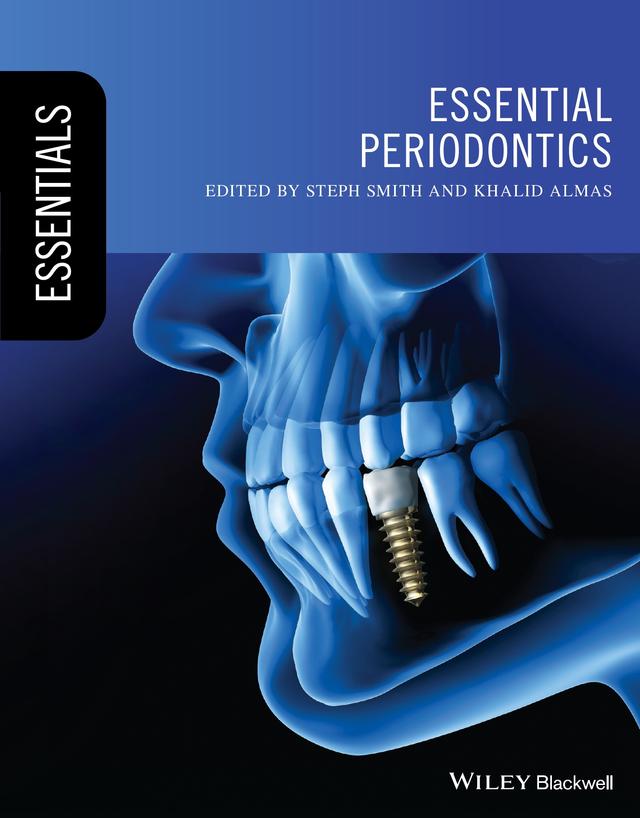 Essential Periodontics 2022