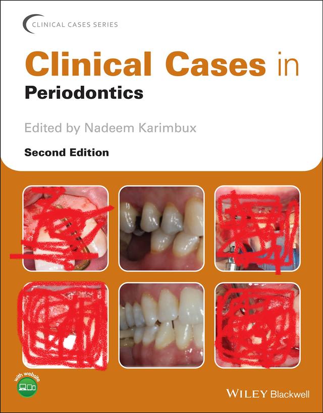 Clinical cases in periodontics 2022
