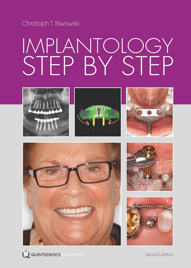 Implantology Step by Step 2015