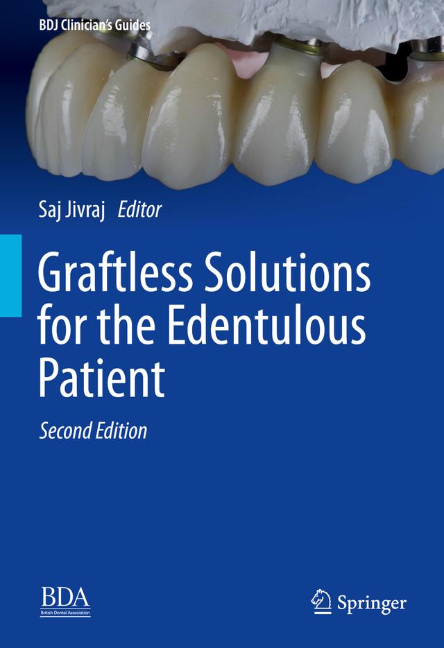 Graftless Solutions for the Edentulous Patient 2023