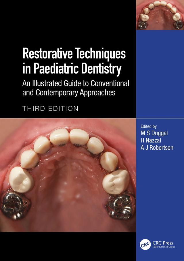Restorative Techniques in Paediatric Dentistry 2024