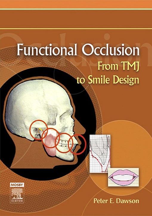 Functional Occlusion From TMJ to Smile Design 2007
