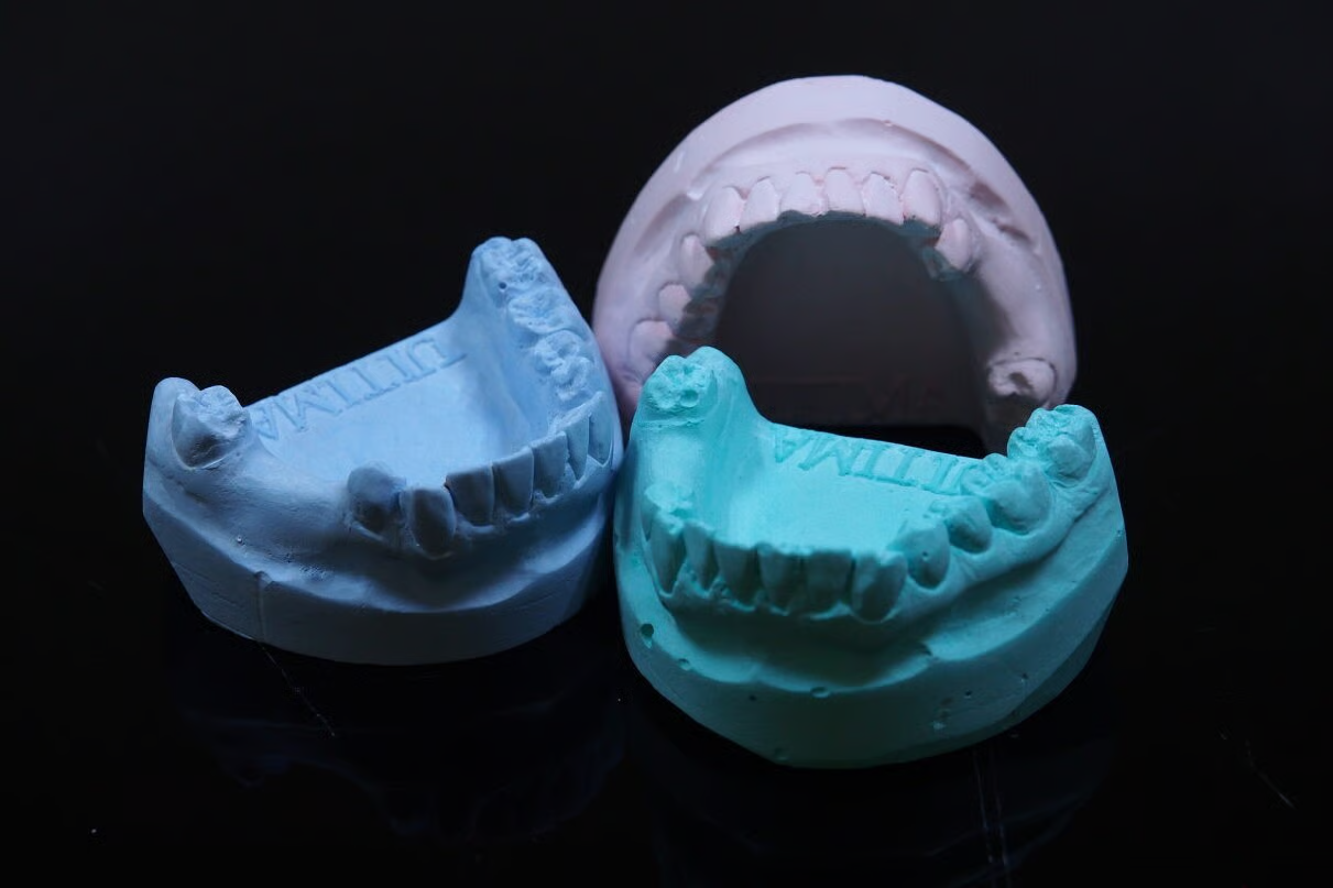 Anatomical dental study models showing Class I, II, and III malocclusions for patient education.