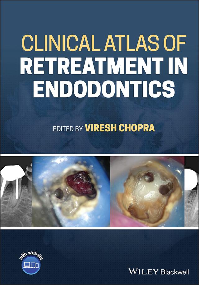 Clinical Atlas of Retreatment in Endodontics 2021