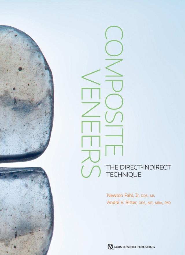 Composite Veneers The Direct-Indirect Technique 2020