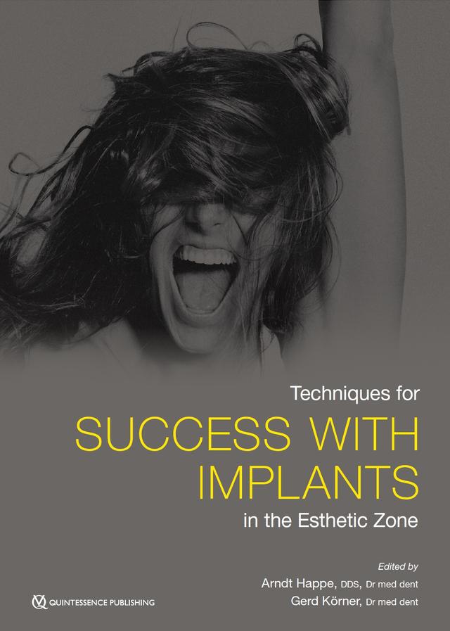 Techniques for Success with Implants in the Esthetic Zone 2019