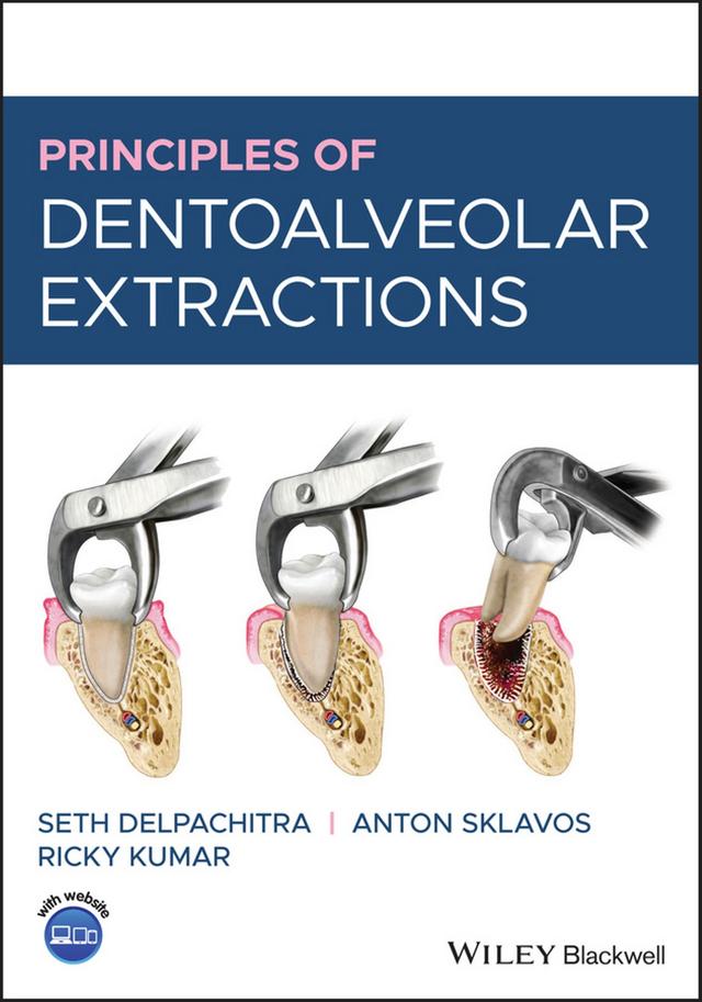 Principles of Dentoalveolar Extractions 2021