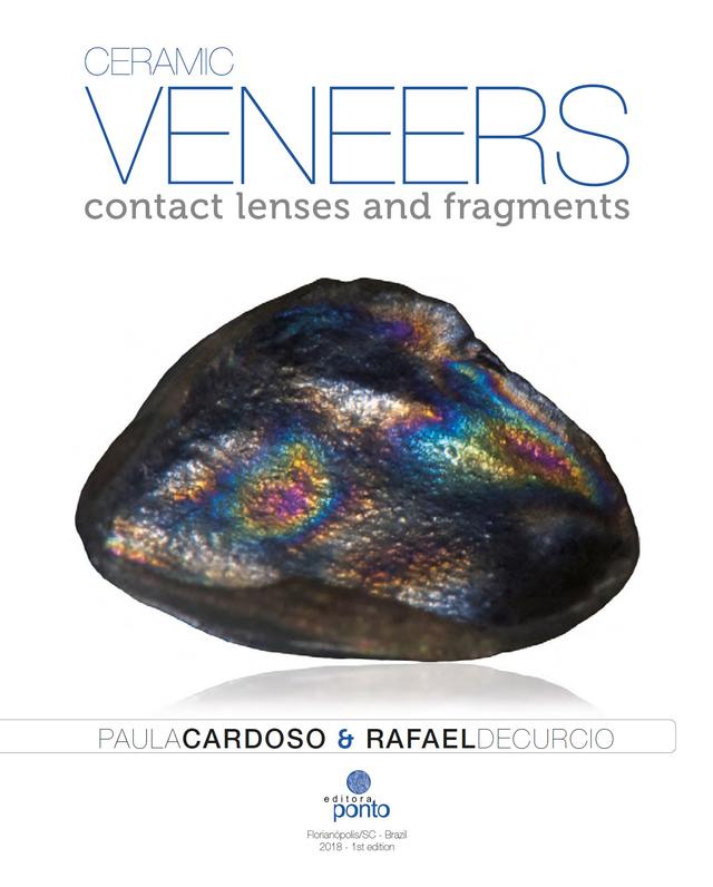 Ceramic Veneers Contact Lenses and Fragments 2018