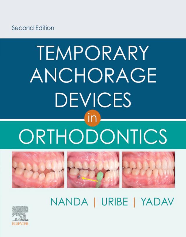 Temporary Anchorage Devices in Orthodontics 2020
