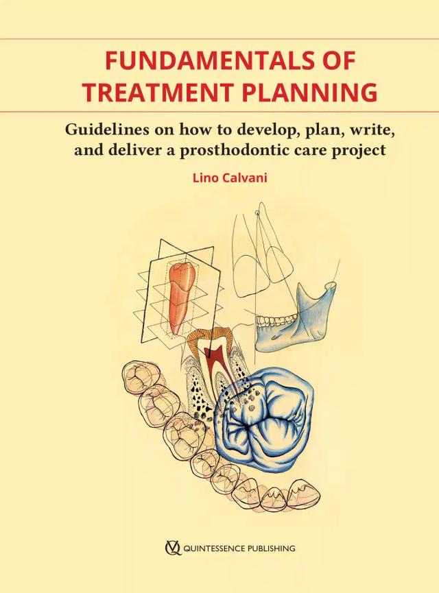 Fundamentals of Treatment Planning Guidelines on How to Develop, Plan, Write and Deliver a Prosthodontics Care Project 2020