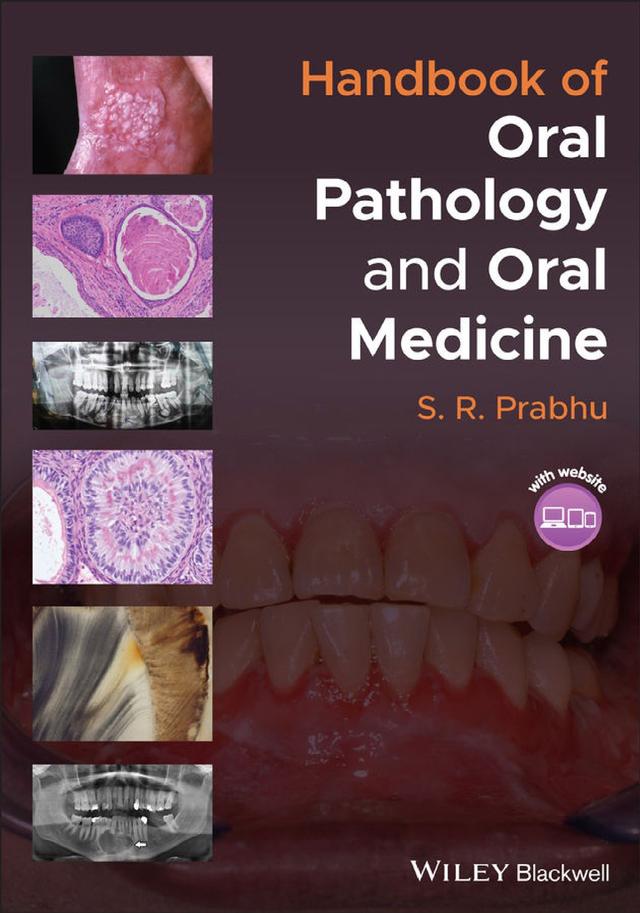 Handbook of Oral Pathology and Oral Medicine 2022