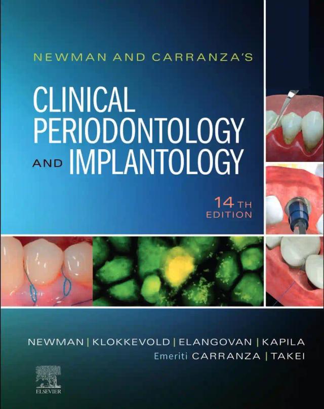 Newman and Carranza's Clinical Periodontology and Implantology 2024