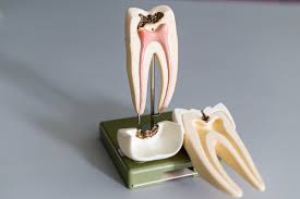Endodontics