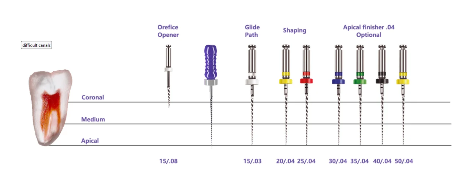 Plex V rotary endodontic file 35/04 for root canal shaping