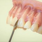 Dental model with a tooth being filed using dental tools on a light green background