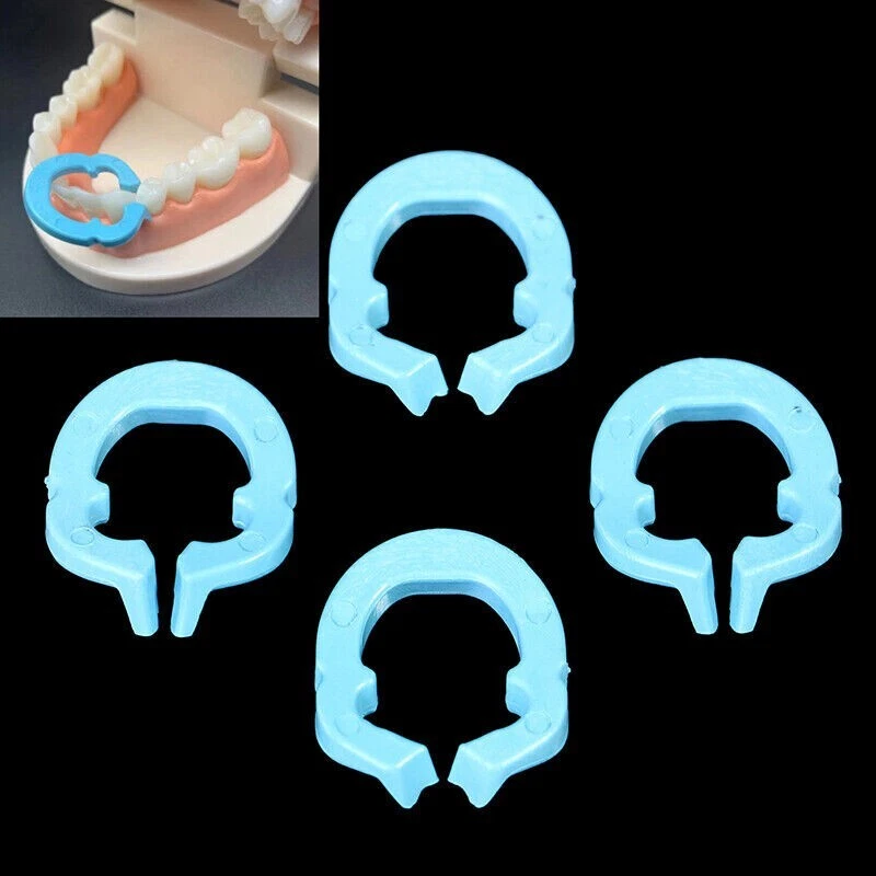 Set of blue dental impression trays on a black background with an inset showing their use on a dental model.