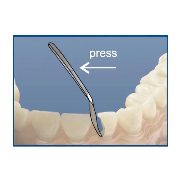 Illustration of a dental tool being used on teeth with 'press' text and arrow.