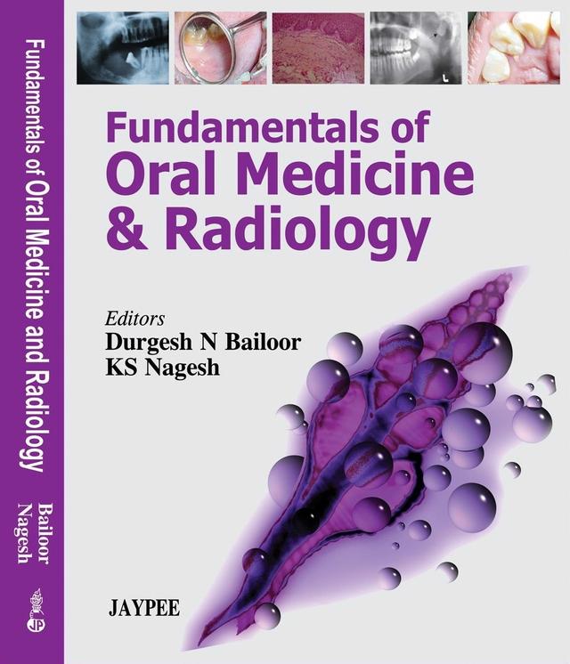 Fundamentals of Oral Medicine and Radiology 2005