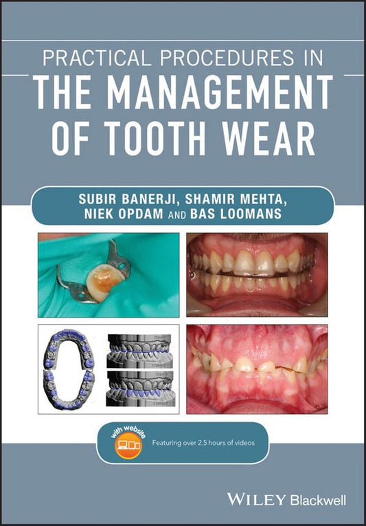 Practical Procedures in the Management of Tooth Wear 2020
