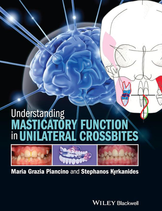 Understanding Masticatory Function in Unilateral Crossbites 2016
