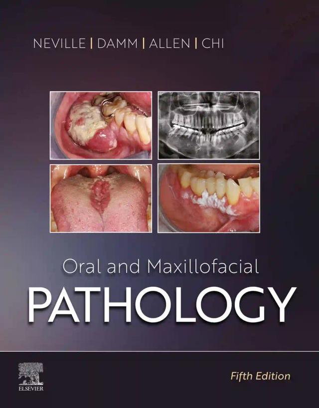Oral and Maxillofacial Pathology 2024