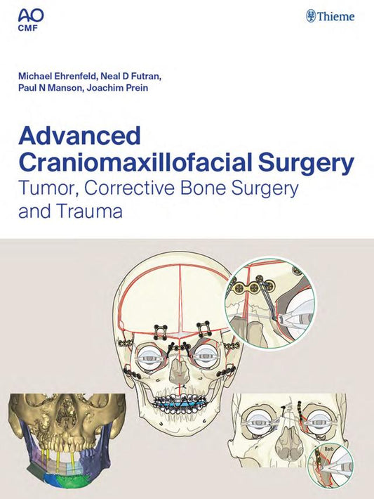 Advanced Craniomaxillofacial Surgery Tumor, Corrective Bone Surgery and Trauma 2020