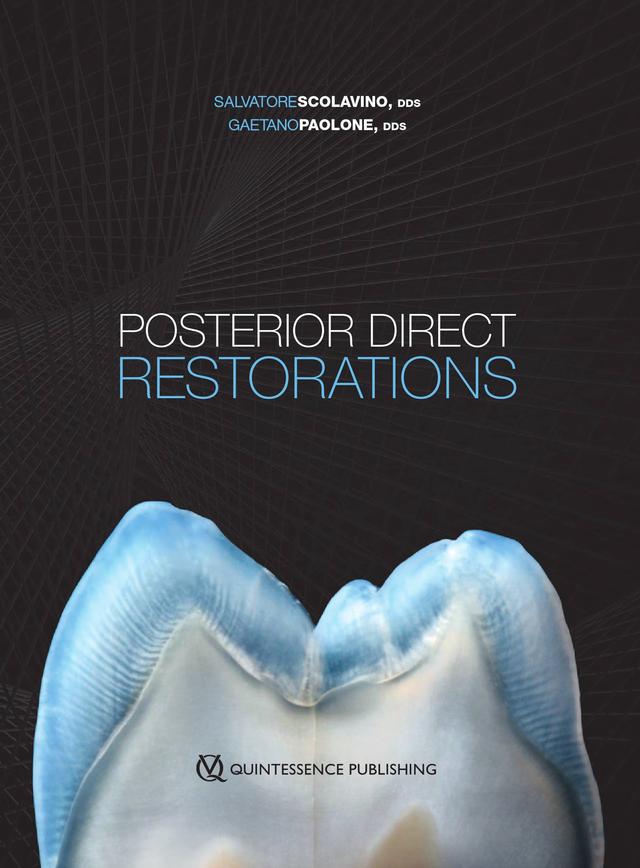 Posterior Direct Restorations 2021