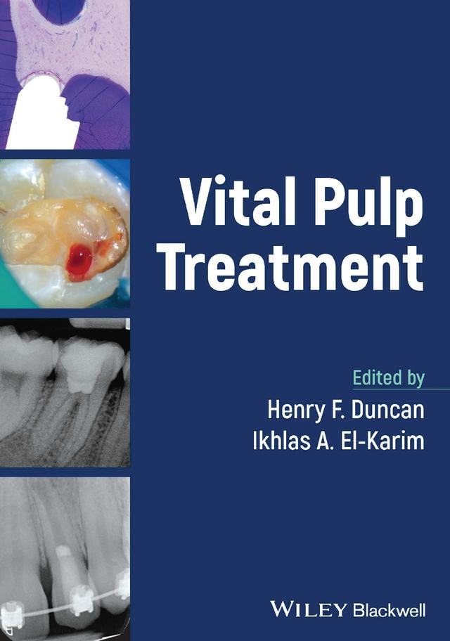 Vital Pulp Treatment 2024