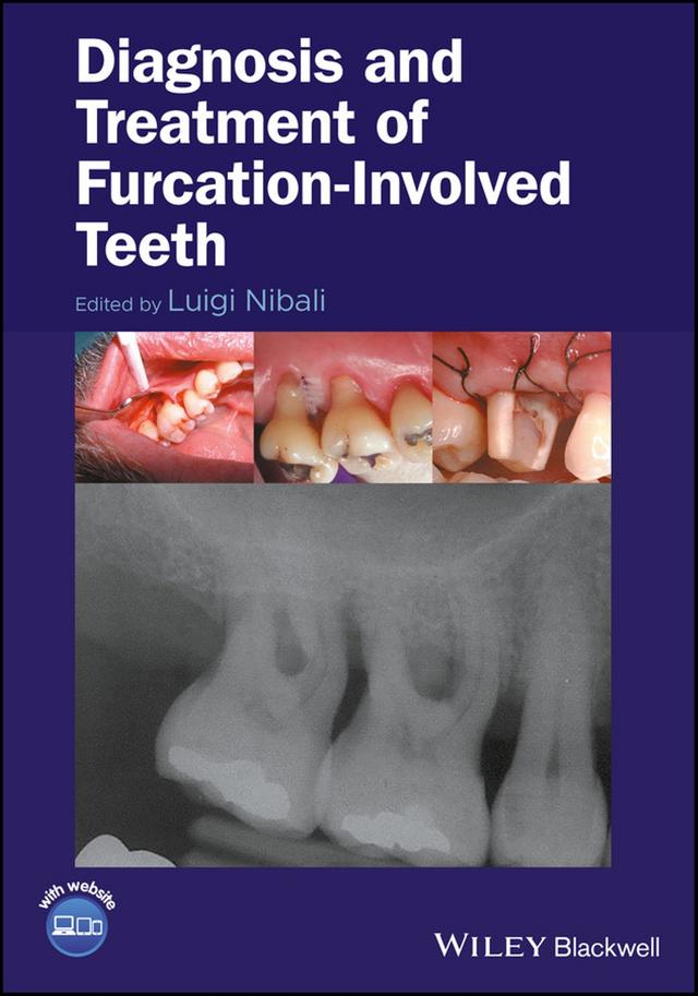 Diagnosis and treatment of furcation-involved teeth 2018