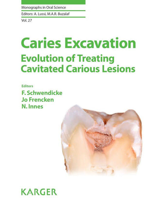 Caries Excavation Evolution of Treating Cavitated Carious Lesions 2018