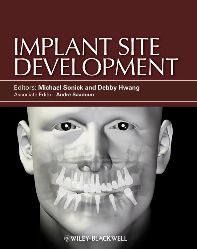 Implant Site Development 2012