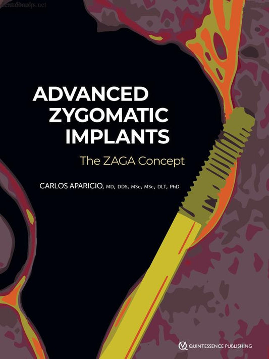 Advanced Zygomatic Implants- The ZAGA Concept 2024