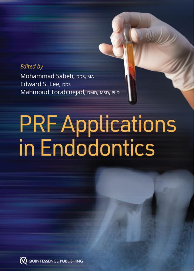 PRF Applications in Endodontics 2020