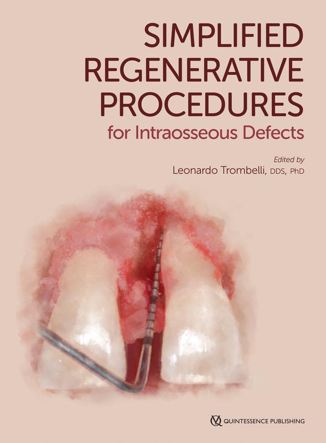 Simplified Regenerative Procedures for Intraosseous Defects 2020