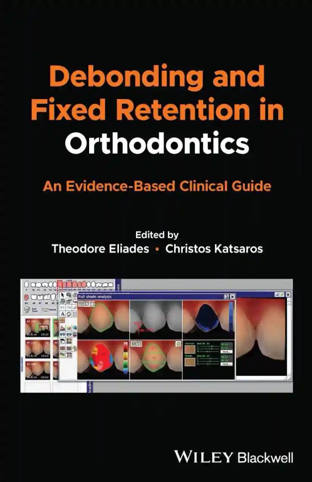 Debonding and Fixed Retention in Orthodontics 2024