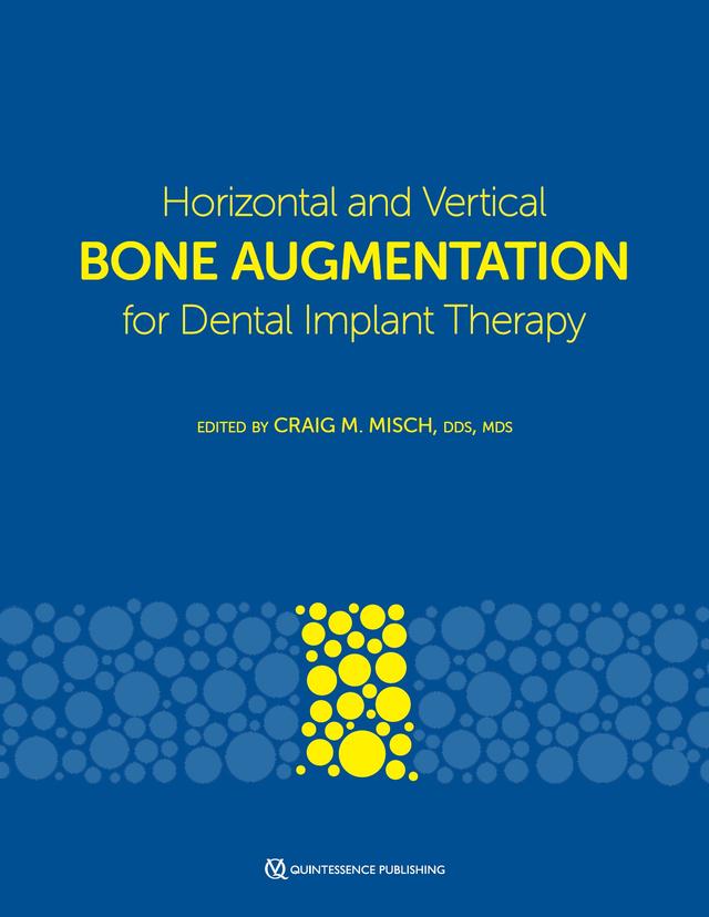 Horizontal and Vertical Bone Augmentation for Dental Implant Therapy 2024