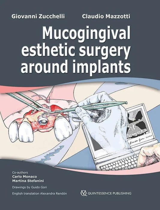 Mucogingival Esthetic Surgery around Implants 2022