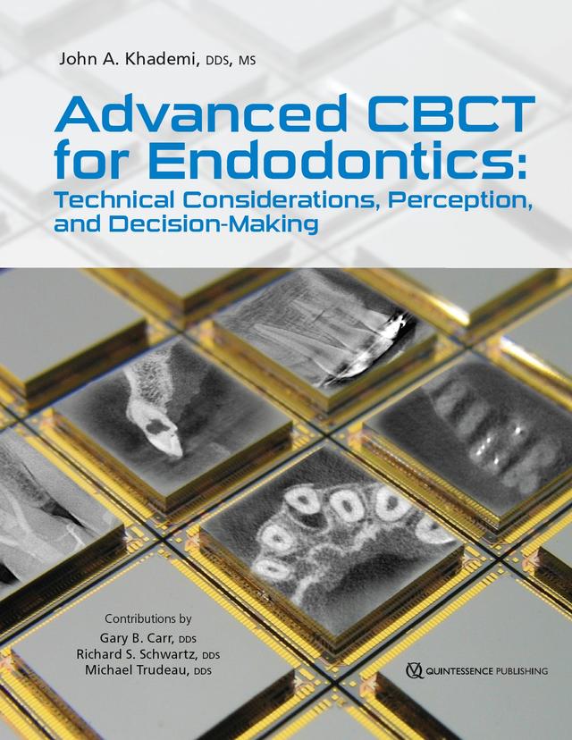 Advanced CBCT for Endodontics Technical Considerations, Perception, and Decision-Making 2017
