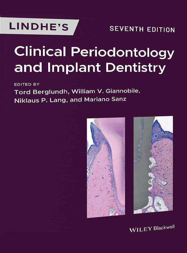 Lindhe’s Clinical Periodontology & Implant Dentistry 2022