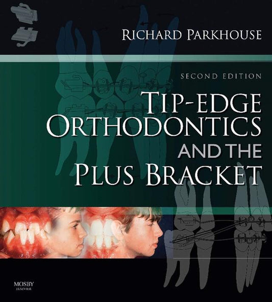 Tip-Edge Orthodontics and the Plus Bracket 2009