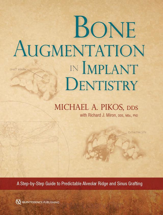 Bone Augmentation in Implant Dentistry A Step-by-Step Guide to Predictable Alveolar Ridge and Sinus Grafting 2019