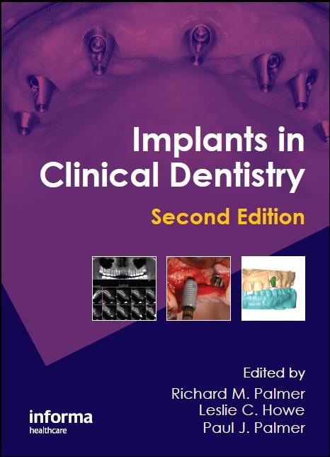 Implants in Clinical Dentistry 2012