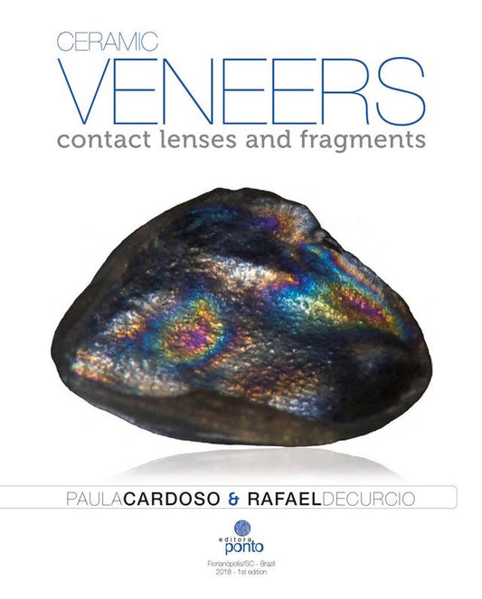 Ceramic Veneers Contact Lenses and Fragments 2018